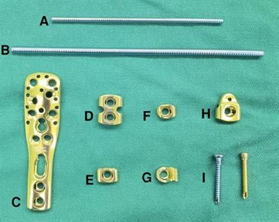 Role of the ortho-bridge system in the length unstable subtrochanteric femur fracture in school going children: a retrospective clinical study of 19 cases